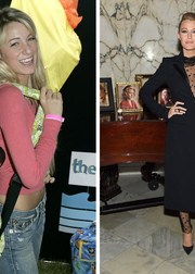 До и после: Как изменились знаменитости за 10 лет